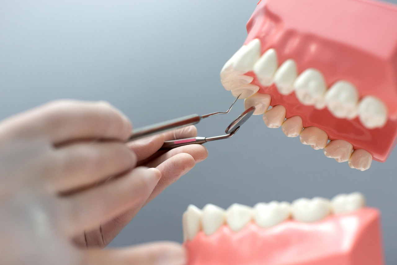 Implantes Dentários: Restaurando Sorrisos